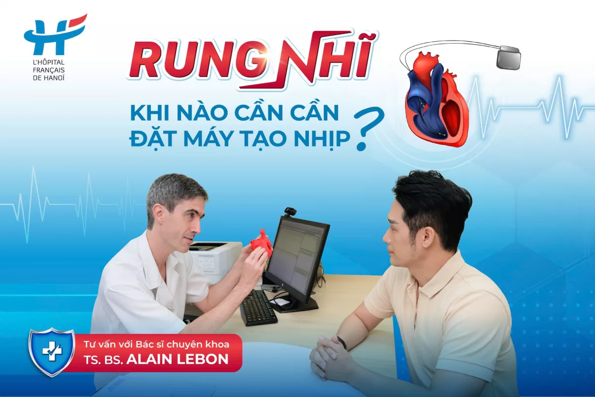 RUNG NHĨ: KHI NÀO CẦN ĐẶT MÁY TẠO NHỊP
